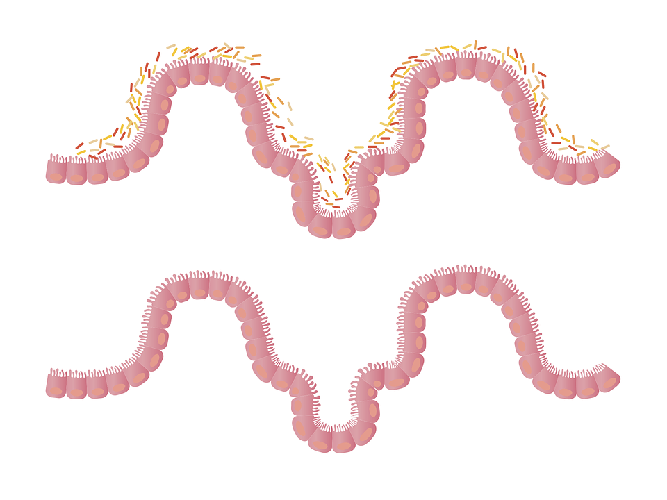 intestines-1468807_960_720.png