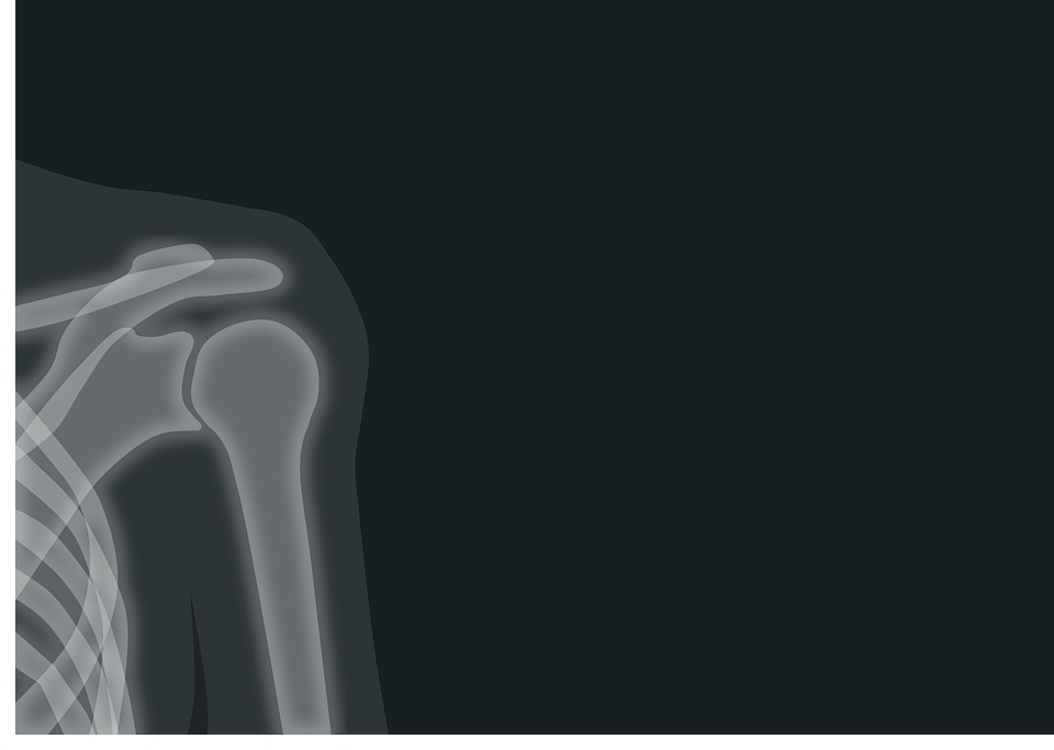 x-ray-1884888_960_720.png